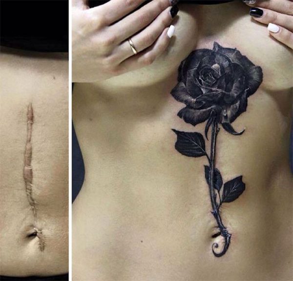 Tatouages Cr Atifs Qui Transforment Les Cicatrices En Oeuvres D Art