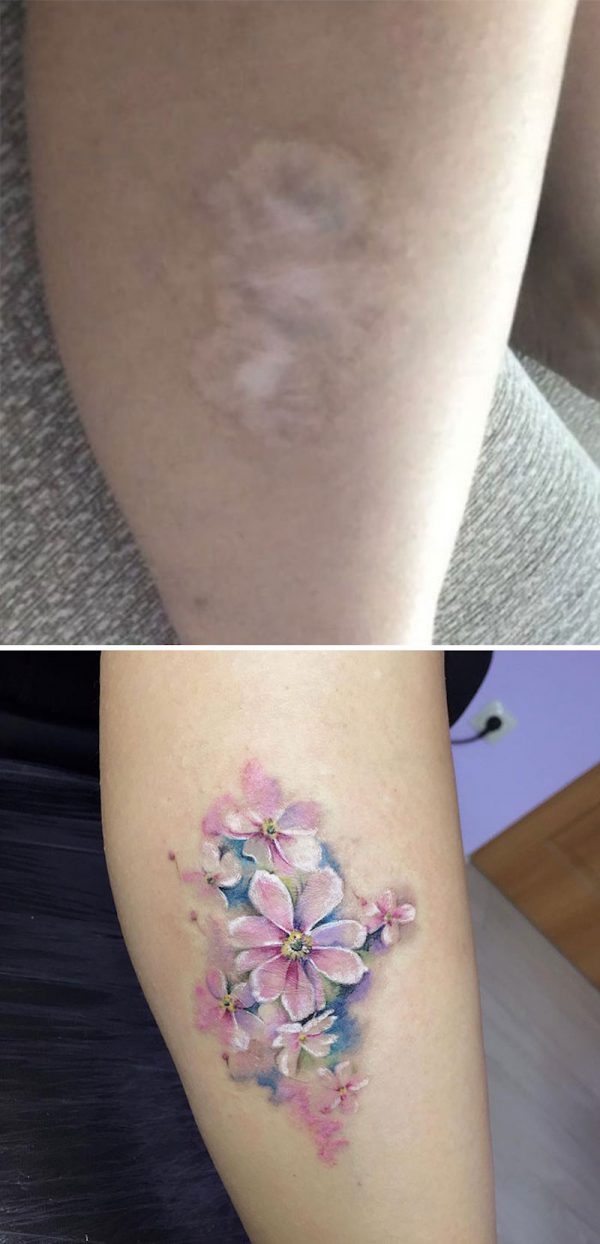 30 tatouages créatifs qui transforment des cicatrices en véritables œuvres d