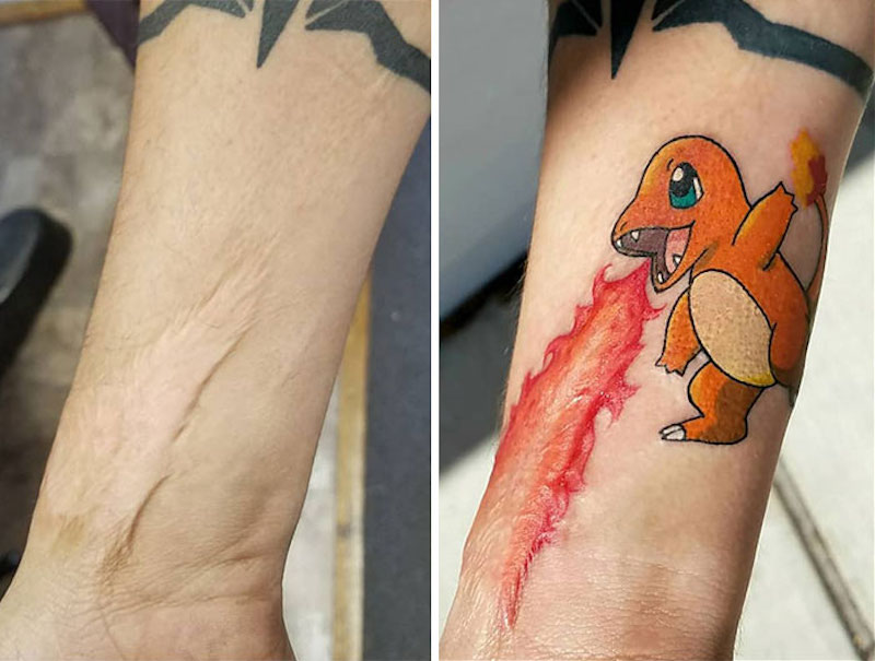 30 tatouages créatifs qui transforment des cicatrices en véritables œuvres d’art ! By Mélissa N.  Tatouages-masquent-cicatrices-16