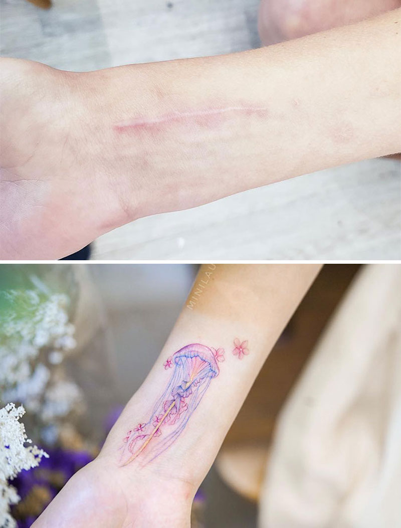 30 tatouages créatifs qui transforment des cicatrices en véritables œuvres d’art ! By Mélissa N.  Tatouages-masquent-cicatrices-19