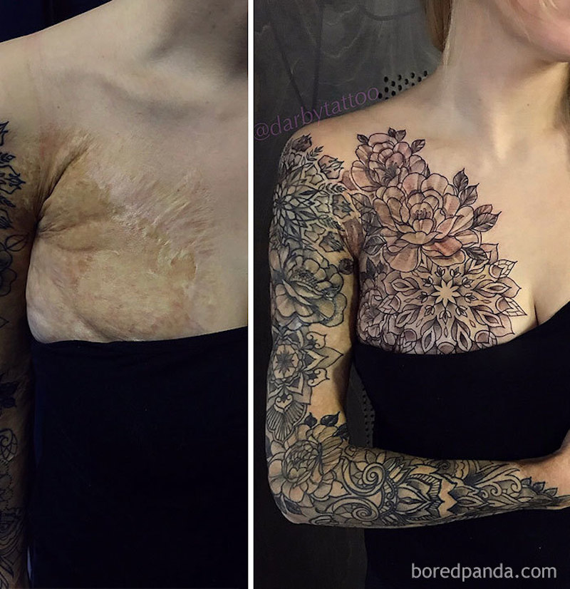 30 tatouages créatifs qui transforment des cicatrices en véritables œuvres d’art ! By Mélissa N.  Tatouages-masquent-cicatrices-2