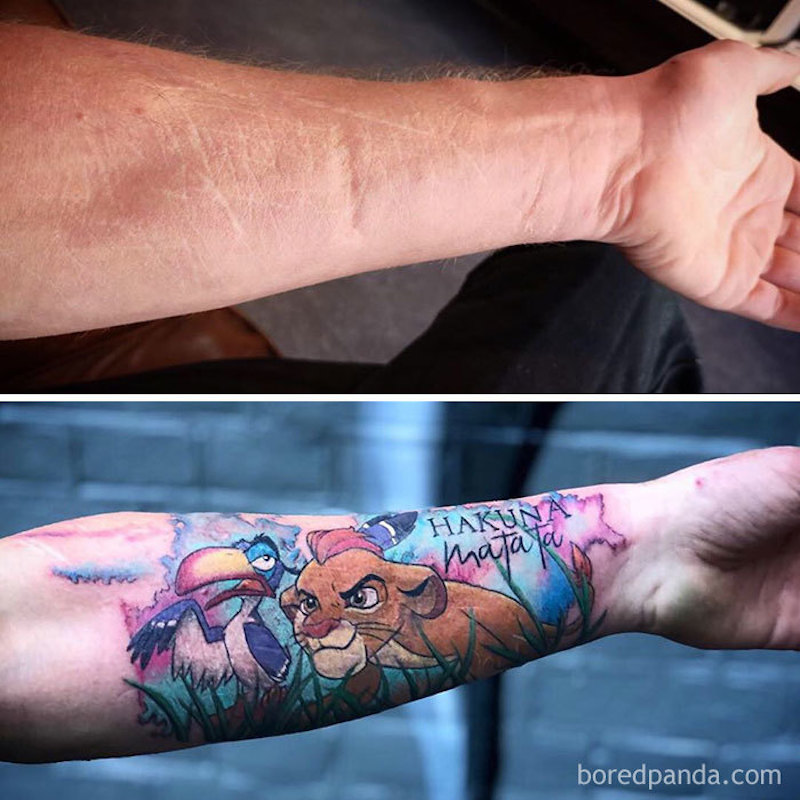 30 tatouages créatifs qui transforment des cicatrices en véritables œuvres d’art ! By Mélissa N.  Tatouages-masquent-cicatrices-27