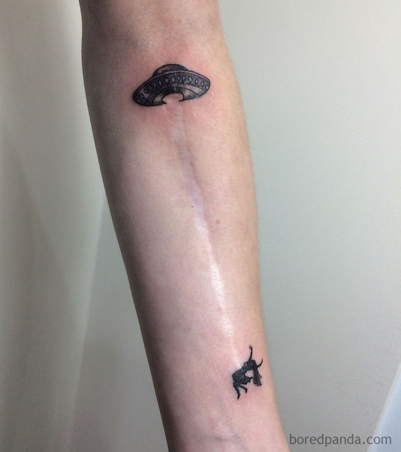 30 tatouages créatifs qui transforment des cicatrices en véritables œuvres d’art ! By Mélissa N.  Tatouages-masquent-cicatrices-3