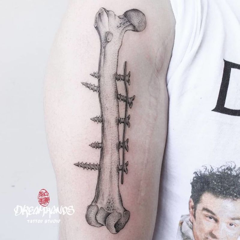 30 tatouages créatifs qui transforment des cicatrices en véritables œuvres d’art ! By Mélissa N.  Tatouages-masquent-cicatrices-30