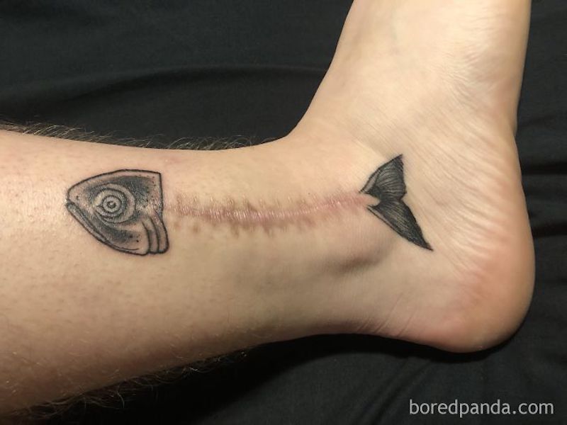 30 tatouages créatifs qui transforment des cicatrices en véritables œuvres d’art ! By Mélissa N.  Tatouages-masquent-cicatrices-4