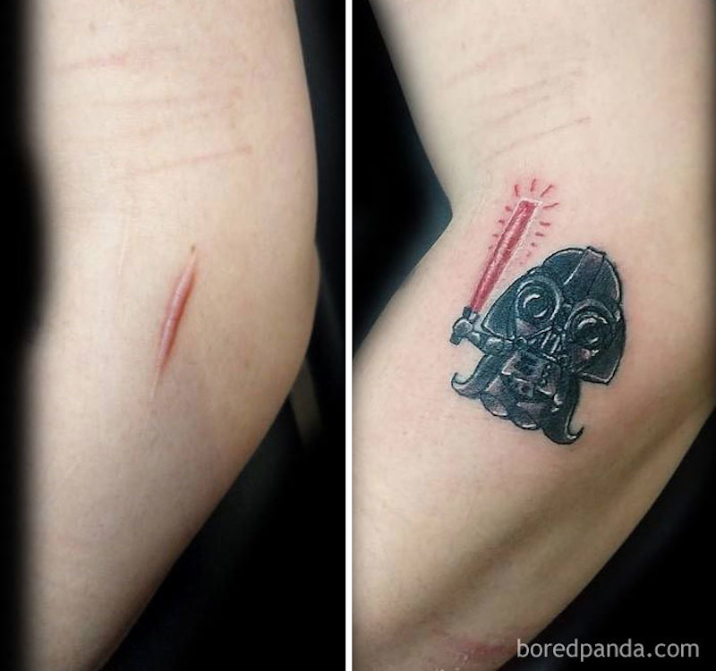 30 tatouages créatifs qui transforment des cicatrices en véritables œuvres d’art ! By Mélissa N.  Tatouages-masquent-cicatrices-5